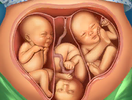 立即手术医院游戏：体验医生经营挑战